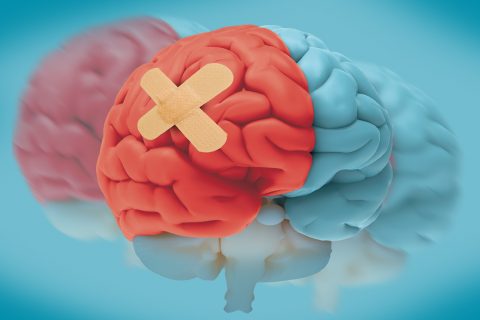 Redbird Scholar cover image showing a model brain that is half red and half blue and with a Band-Aid on the red side