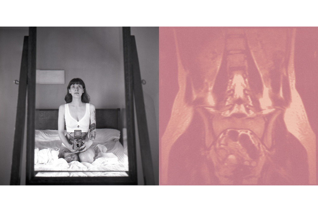 A black and white photo of Sarah Eckstine in a mirror on the left, with a pink, blurry sonogram image on the left.